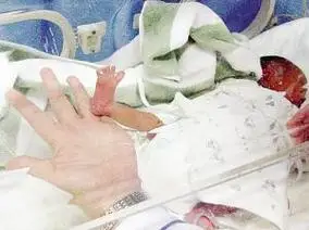 任中华 张凌飞 摄"人造子宫"助他过了三关,两个月后长到5.