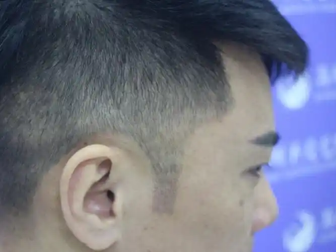 去理发店的时候理发师说我的鬓角太短不好配发型,说要_圈子-新氧美容