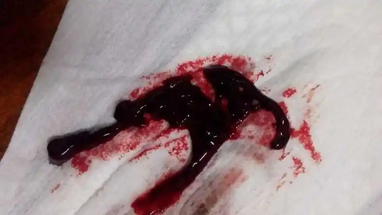 月经的血偏黑色是什么原因-图片大观-奇异网