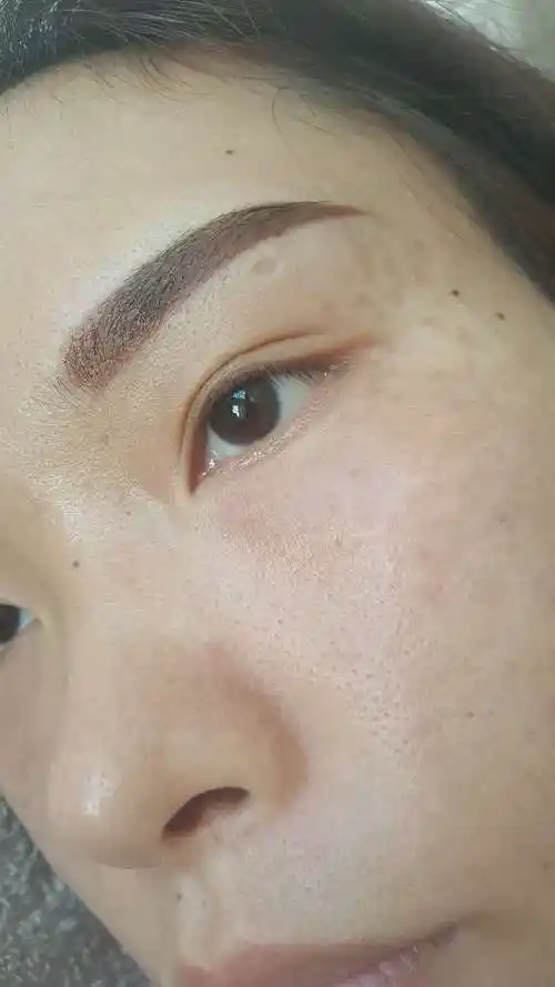 教授你好我眼睛周围有一些斑不知道能有什么方法能去掉毛孔也