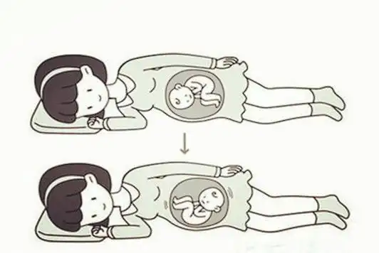 胎位横位怎么纠正图横位孕妈妈必知的胎位纠正方法