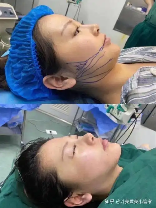 杭州有做黄金微雕好的医生吗