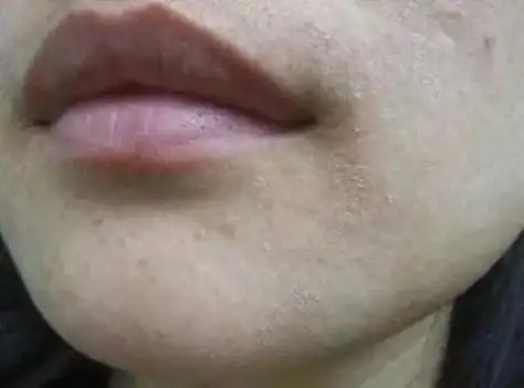 入冬皮肤干燥起皮暗黄试试爆款大补面霜一抹皮肤续命般水润白嫩