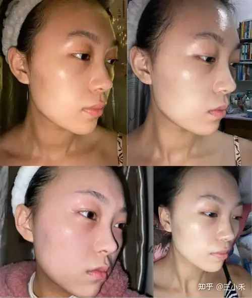 不要吃美白片,丸,莫打美白针,会反黑!会反黑!会反黑!