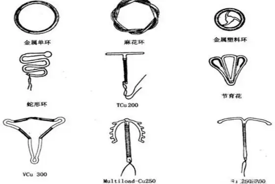 上环当天不能同房毋庸置疑那么带环最短几天可以同房