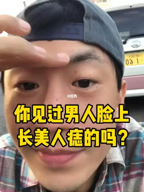 姐姐说我这是朱砂痣 真的吗?