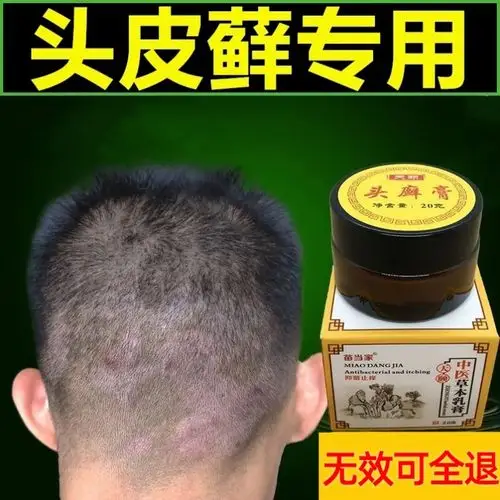 头皮屑癣头皮藓药头皮真菌感染去头藓毛囊炎头皮癣专用药膏洗发水