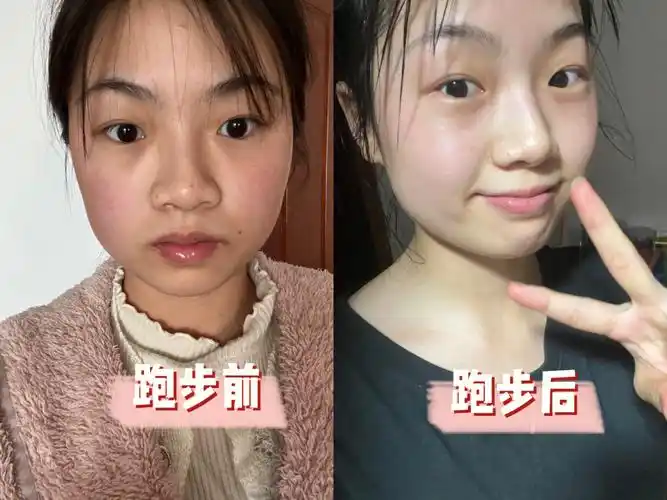 浅谈一下跑步两个月给我带来了什么皮肤篇