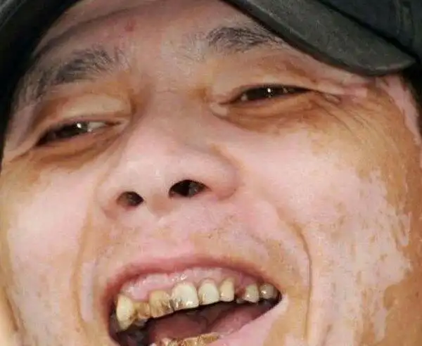 杨颖,杨幂等女星整牙如整容, 这些牙齿很丑的男星为啥不整整?