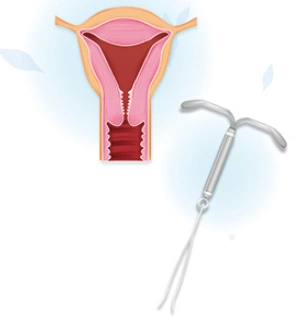 节育环应该什么时间取出来这个年龄比较好不然对女性伤害很大