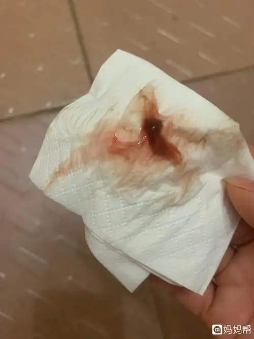 技术好!着床成功后出血图片"层出不穷"-第1张图片-益途网