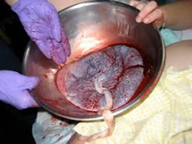 人胎盘详细的特征图片