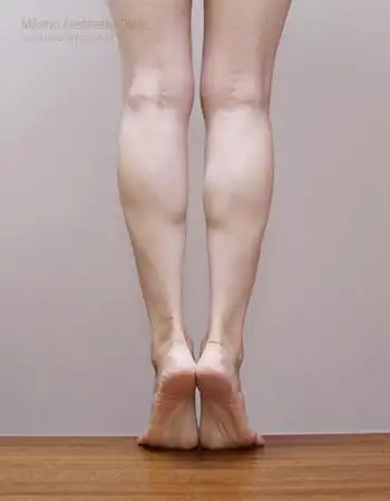 小静小腿腓肠肌发达图片