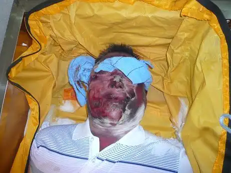 姜献宗惨死一年多 凶手被放跑