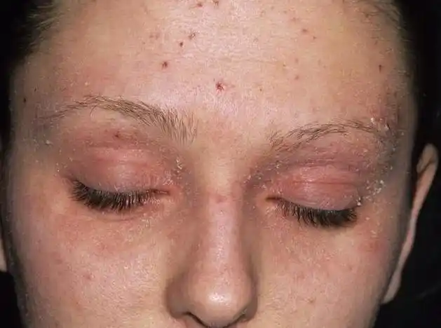 皮肤老化也是有滋生苗头的,要想挽救皮肤恶化状态,光靠护肤品是绝对不