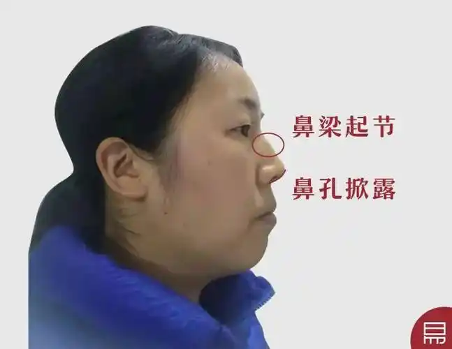 鼻梁低矮财运一定不好吗真人看相