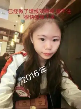 16岁中国网红从13岁开始整容已累积60次最后成果网民吓翻还不如不整