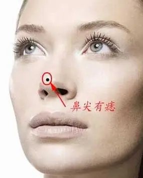 这些地方有痣是千年一遇的吉痣 痣相解析