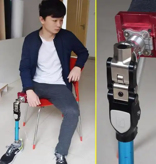 合肥康复专家浅谈液压大腿假肢全接触接受腔
