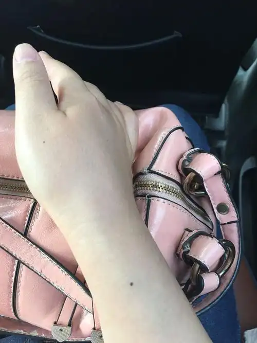 请老师帮我分析一下我手臂上的这几颗痣好不好?有啥寓意?谢谢了.