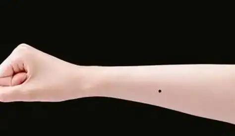 女人手臂各种痣图解
