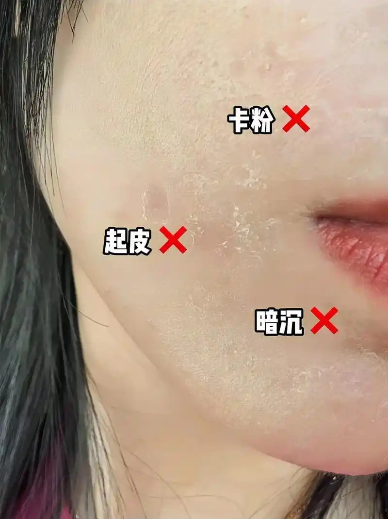 脸上起皮皮,皮肤暗沉粗糙缺水,化妆卡粉,干燥,浮粉?显得老! - 抖音