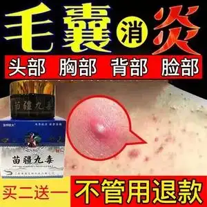 治疗头皮毛囊炎头部硬疙瘩脸部背外阴头上长痘痘专用膏马拉色菌药