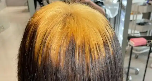 染发爆顶是什么原因