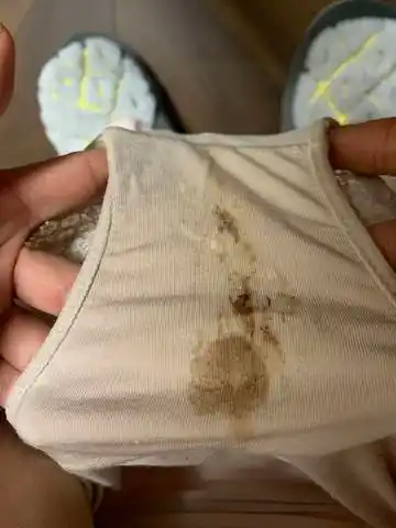 怀孕两个多月了,这两天突然白带呈棕色,是什么原因,有问题吗?