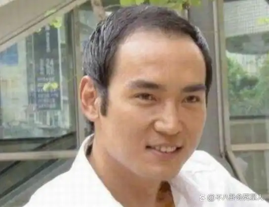 秃头是大家无法攻克的难题,娱乐圈的明星也不例外,尤其是男星们.