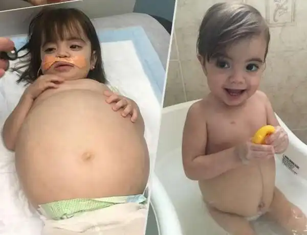 在美国,有一个3岁的小女孩,她长得非常可爱,但是,她的肚子却非常大,看