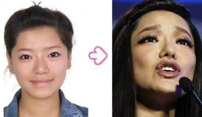 江映蓉整容前后照片对比 江映蓉整容失败大变脸