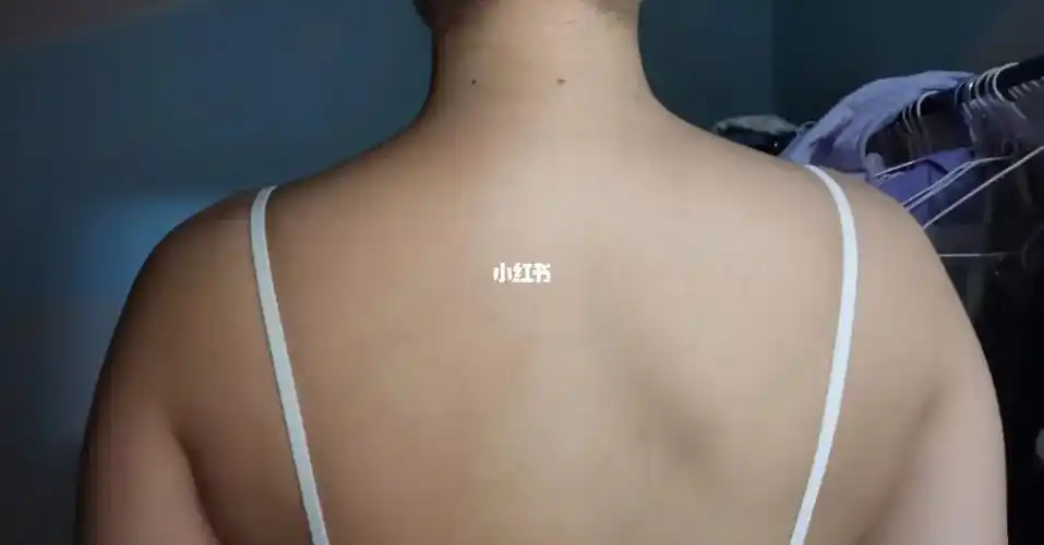 这是有斜方肌还是没有,感觉我的背好厚