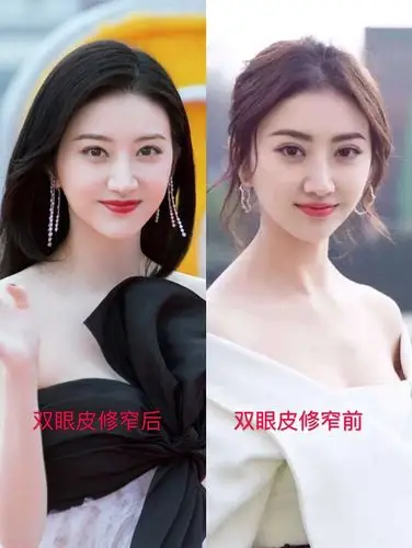 景甜也学李小璐把双眼皮修窄了,变了个人?