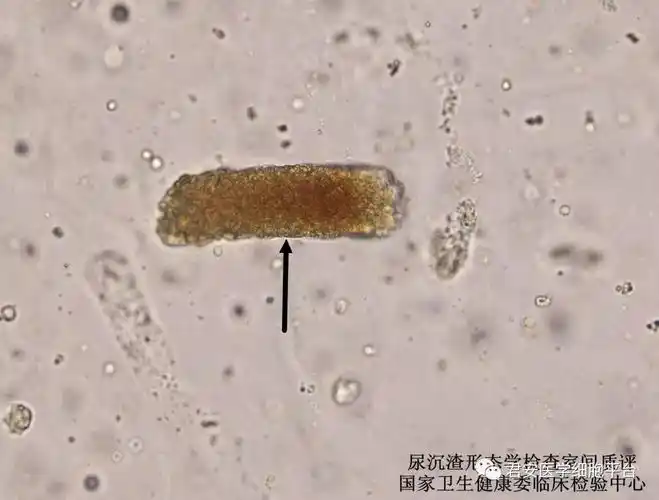 (未染色标本)请报告箭头所指图象的名称2019507红细胞点击空白处查看