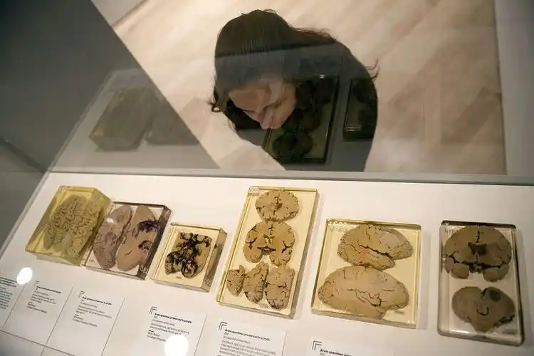 英"人脑"展 展出爱因斯坦大脑切片(组图)