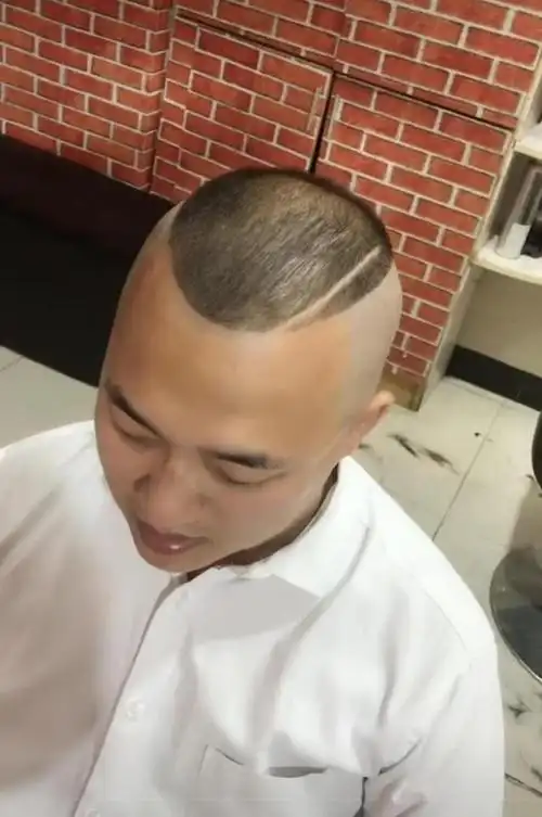 秃顶男理完发后,秒变帅气时尚小鲜肉,网友:逆天了!