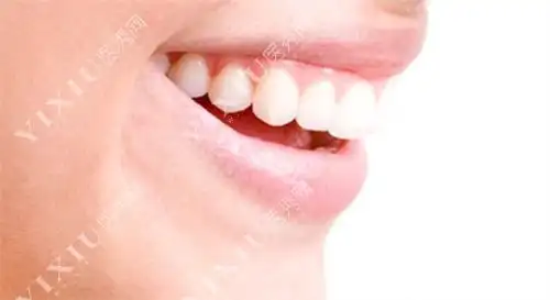 牙齿侧面图
