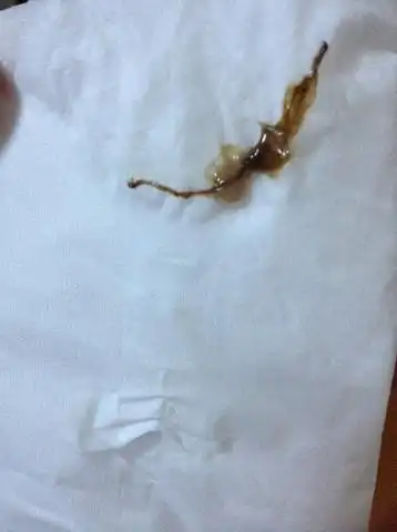 怀孕6周有褐色分泌物,怎麼办?哪个宝妈有经验的指点一二.