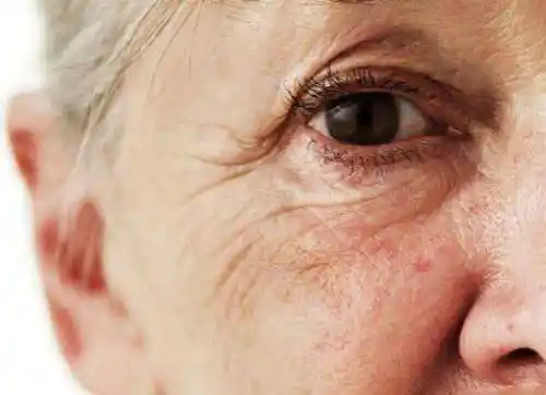 女人中年衰老别害怕, 每天吃点它, 皮肤嫩到掐出水来! 比吃药强