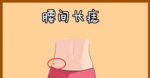 腰间长痣在相学当中,若是一个人的腰间的位置处长有吉痣,往往会有"