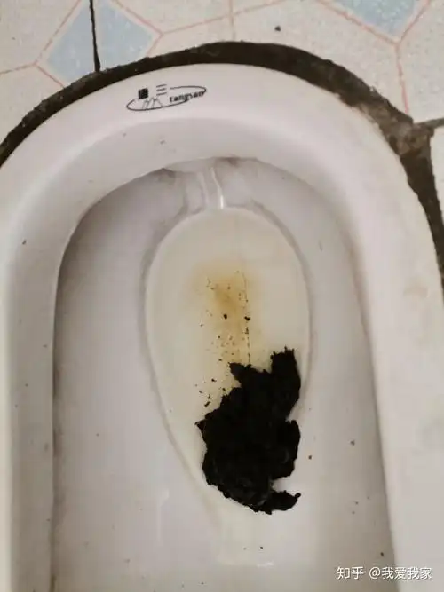 今天上午拉黑便了,很害怕怎么办,想想就想哭,也没有吃猪血鸭血什么的