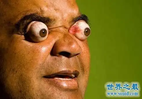 2,巴西奇葩男子能把眼珠弹出来