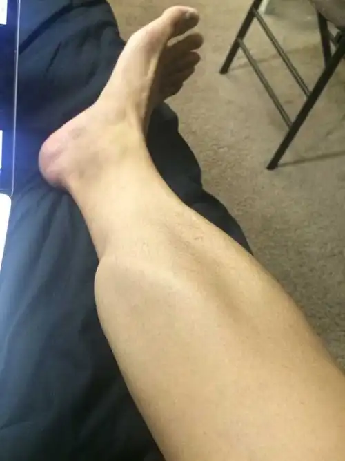 同样需要肌肉的重度参与,为什么总说跑步不会让小腿变粗,而深蹲等却能