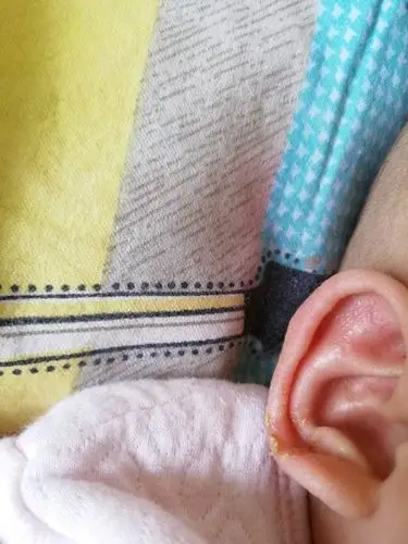 宝宝耳朵长这个了