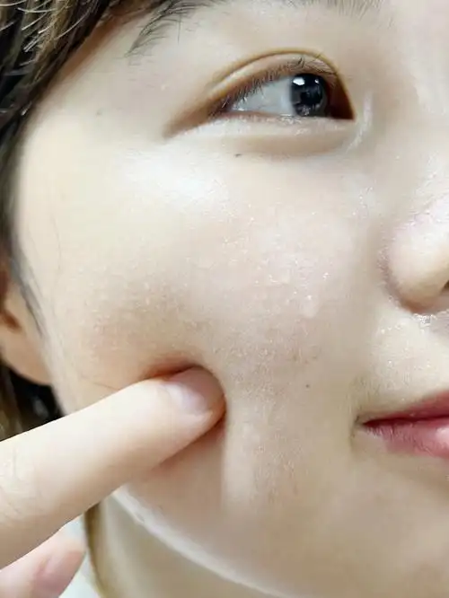 我毛孔大我试过了激动的没睡着