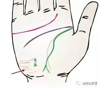 血糖高,糖代谢异常的征兆为手掌外侧月丘处,有一条与腕横纹平行的横纹