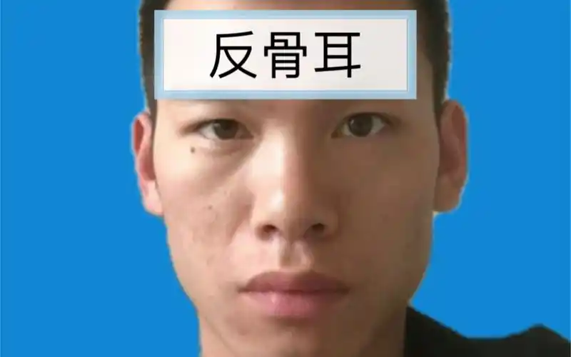 观相识人:反骨耳!