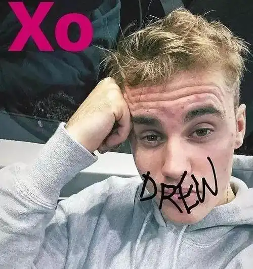 贾斯汀·比伯发文否认嗑药,并自曝患上莱姆病,过的很艰难!