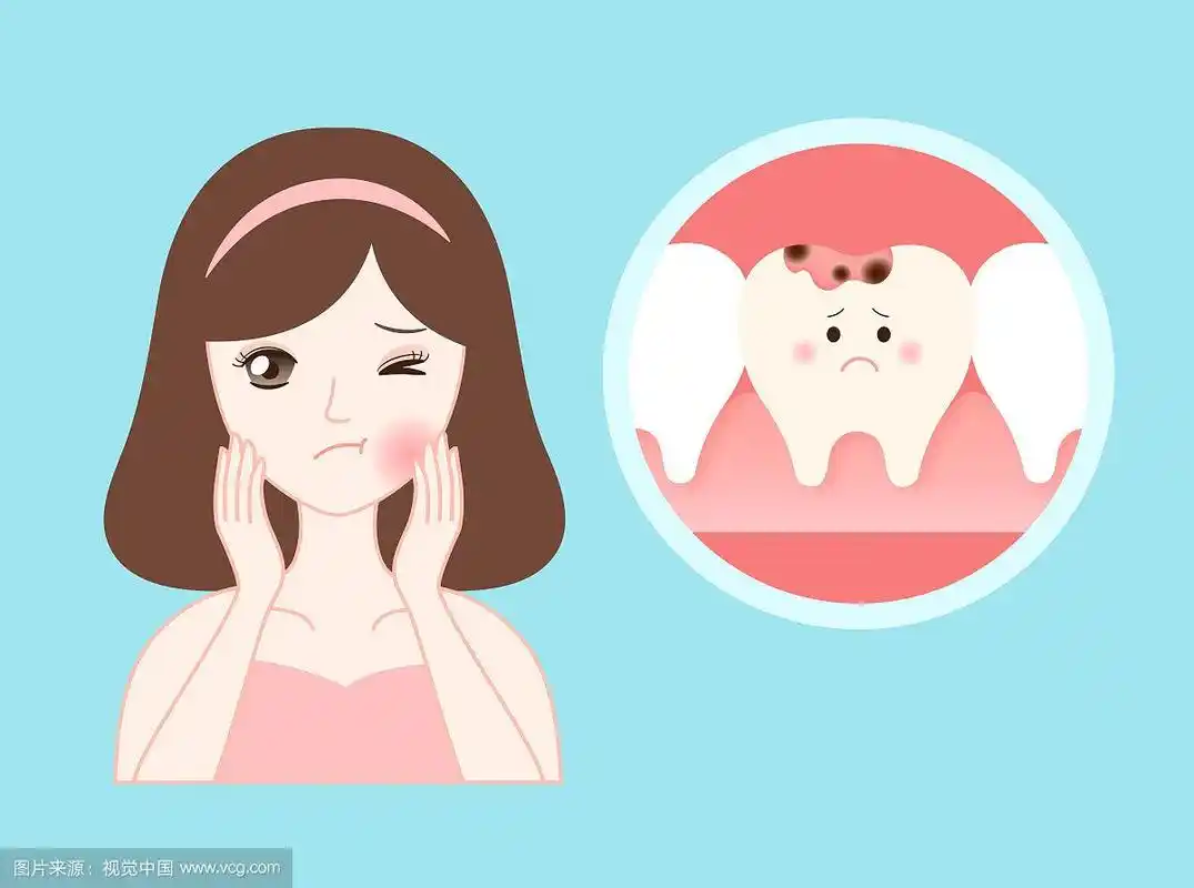 蛀牙牙疼矢量插画